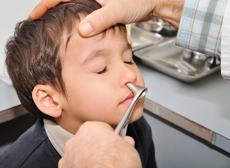 Life-saving tips when a Toddler Stuck Something in the Nose